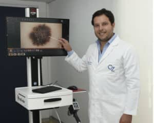 dermatoscopia digital