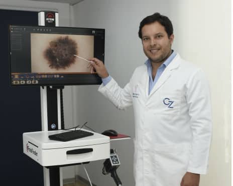 dermatoscopia digital