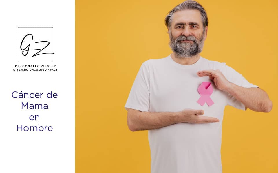 cancer de mama en hombre